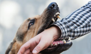 How Shaked Law Personal Injury Lawyers Can Help After a Dog Bite in Miami