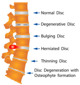 What Is the Structure of Your Spine?